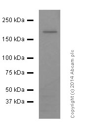 Western blot - Anti-NMDAR2A antibody [EPR2465(2)] (AB124913), expandable thumbnail