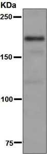Western blot - Anti-NMDAR2A antibody [EPR7063] (AB133265)
