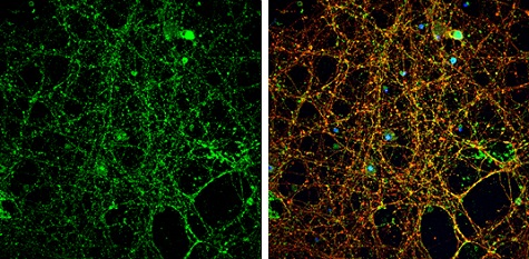 Immunocytochemistry/ Immunofluorescence - Anti-NMDAR2A antibody - N-terminal (AB227233), expandable thumbnail