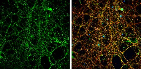 Immunocytochemistry/ Immunofluorescence - Anti-NMDAR2A antibody - N-terminal (AB227233)