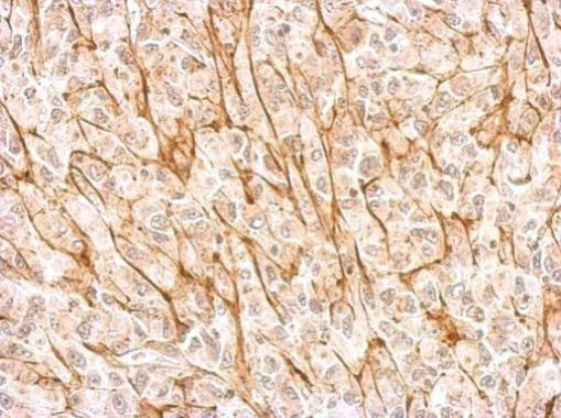 Immunohistochemistry (Formalin/PFA-fixed paraffin-embedded sections) - Anti-NMDAR2A antibody - N-terminal (AB227233)