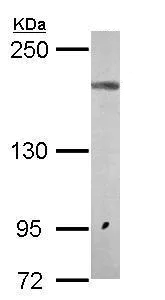 Western blot - Anti-NMDAR2A antibody - N-terminal (AB227233)