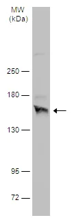 Western blot - Anti-NMDAR2A antibody - N-terminal (AB227233)
