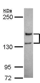 Western blot - Anti-NMDAR2A antibody - N-terminal (AB227233)