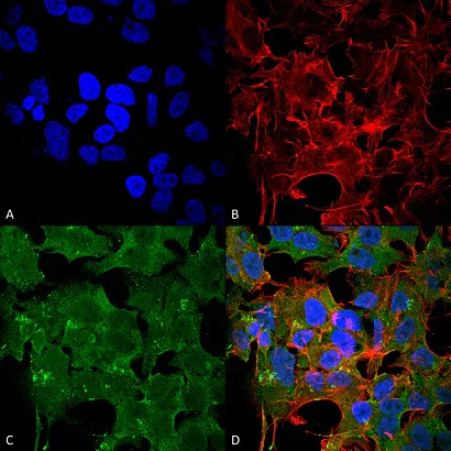 Immunocytochemistry/ Immunofluorescence - Anti-NMDAR2A antibody [N327A/38] - N-terminal (AB174636)