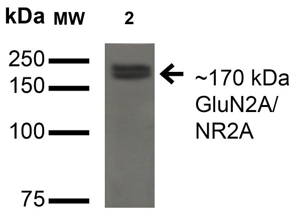 Western blot - Anti-NMDAR2A antibody [N327A/38] - N-terminal (AB174636), expandable thumbnail