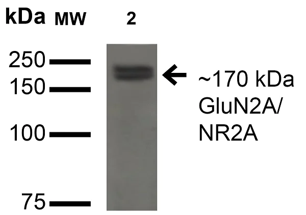 Western blot - Anti-NMDAR2A antibody [N327A/38] - N-terminal (AB174636)