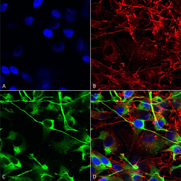 Immunocytochemistry/ Immunofluorescence - Anti-NMDAR2A antibody [S327-95] - N-terminal (AB240884)