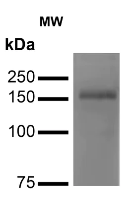 Western blot - Anti-NMDAR2A antibody [S327-95] - N-terminal (AB240884)