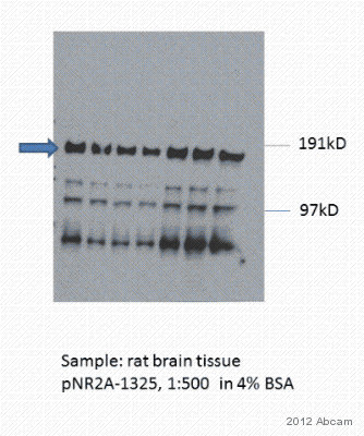 Western blot - Anti-NMDAR2A (phospho Y1325) antibody (AB106590)