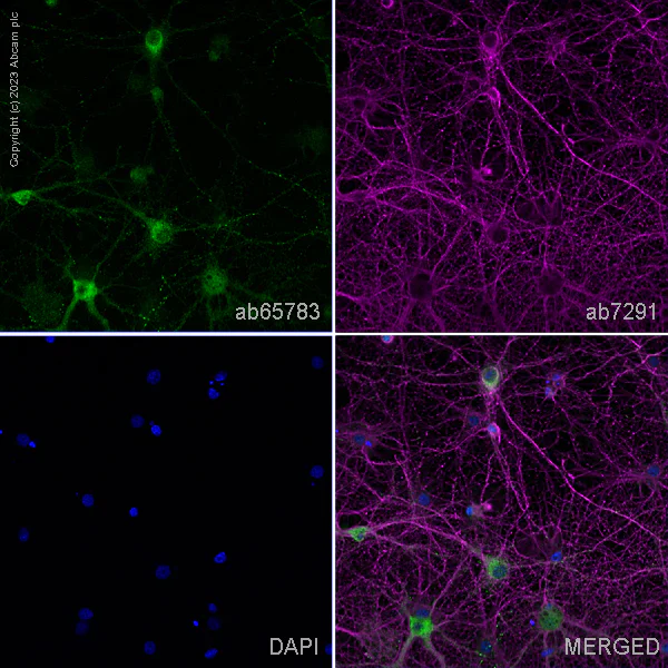 Immunocytochemistry/ Immunofluorescence - Anti-NMDAR2B antibody (AB65783)