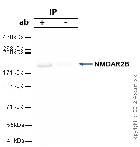 Immunoprecipitation - Anti-NMDAR2B antibody (AB65783)
