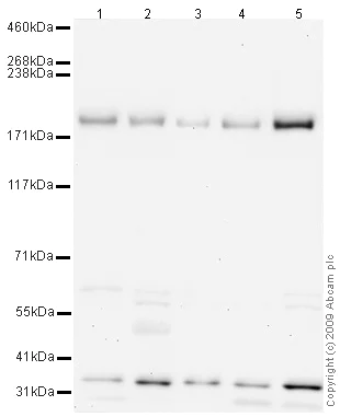 Western blot - Anti-NMDAR2B antibody (AB65783)