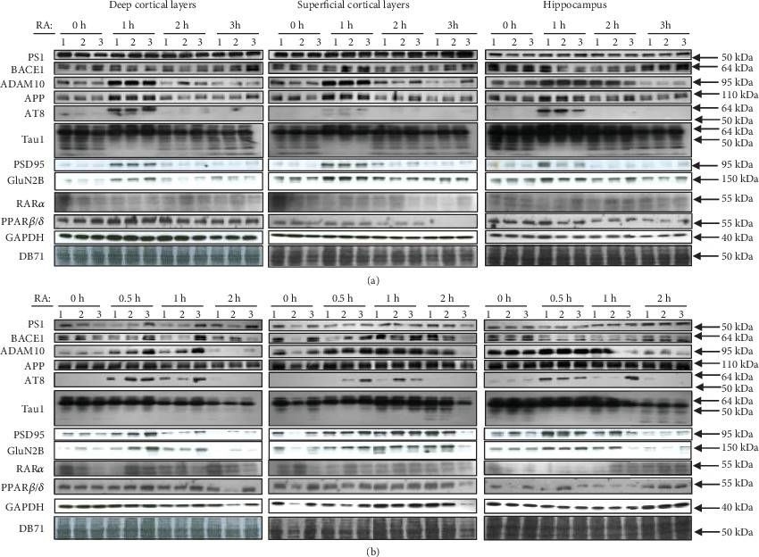 Western blot - Anti-NMDAR2B antibody (AB65783), expandable thumbnail