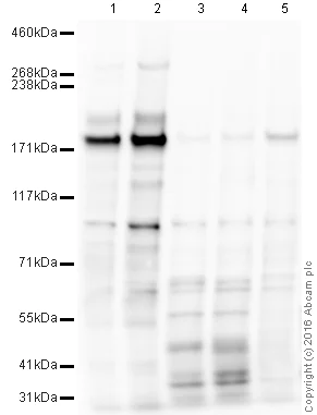 Western blot - Anti-NMDAR2B antibody (AB65783)