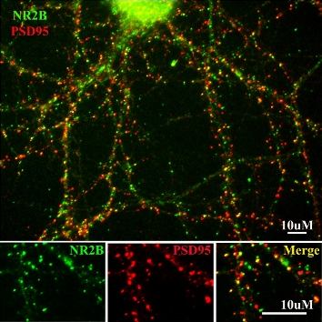 Immunocytochemistry/ Immunofluorescence - Anti-NMDAR2B antibody (AB73001), expandable thumbnail