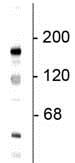 Western blot - Anti-NMDAR2B antibody (AB73001), expandable thumbnail