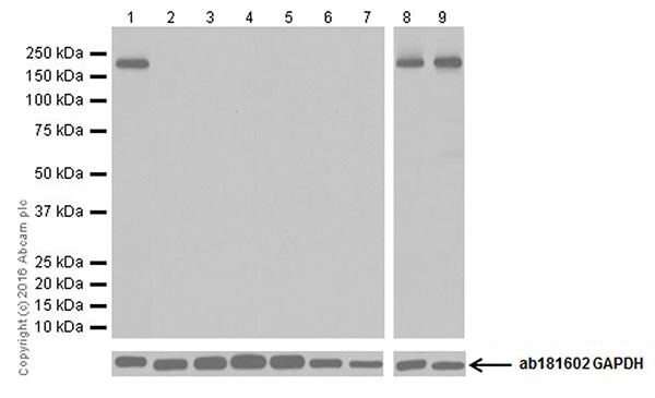 Western blot - Anti-NMDAR2B antibody [EPR19295] (AB183942), expandable thumbnail