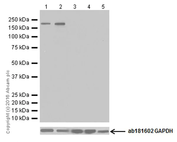 Western blot - Anti-NMDAR2B antibody [EPR19295] - BSA and Azide free (AB250711)