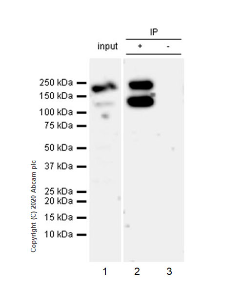 Immunoprecipitation - Anti-NMDAR2B antibody [EPR23460-119] (AB254356), expandable thumbnail