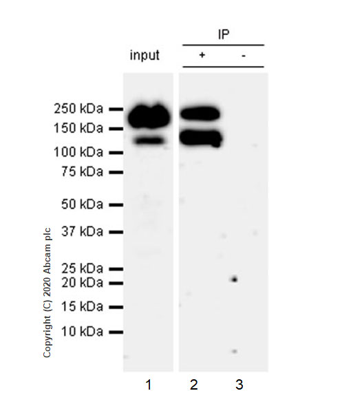 Immunoprecipitation - Anti-NMDAR2B antibody [EPR23460-119] (AB254356), expandable thumbnail