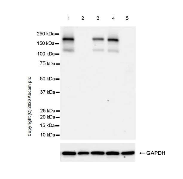 Western blot - Anti-NMDAR2B antibody [EPR23460-119] (AB254356)