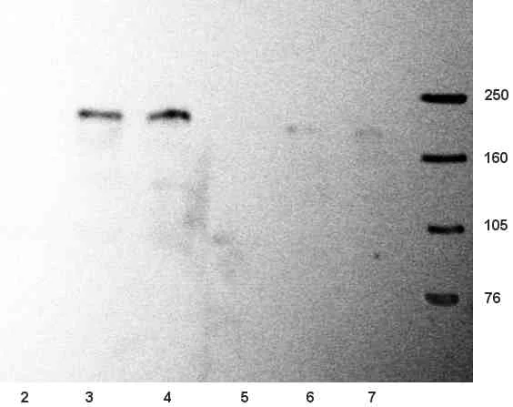 Western blot - Anti-NMDAR2B antibody [NR2B] (AB28373)