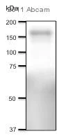 Western blot - Anti-NMDAR2B antibody [NR2B] (AB28373)