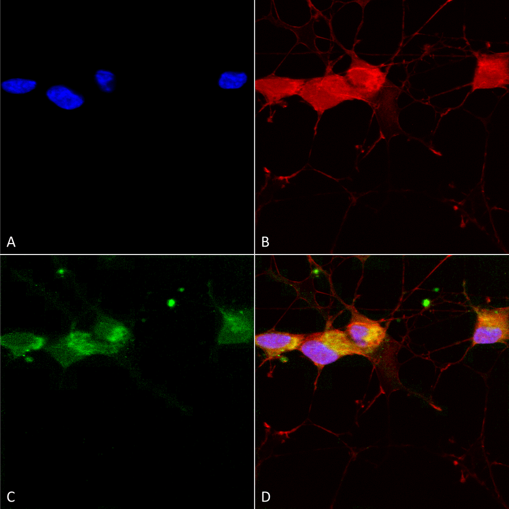 Immunocytochemistry/ Immunofluorescence - Anti-NMDAR2B antibody [S59] (AB93610), expandable thumbnail