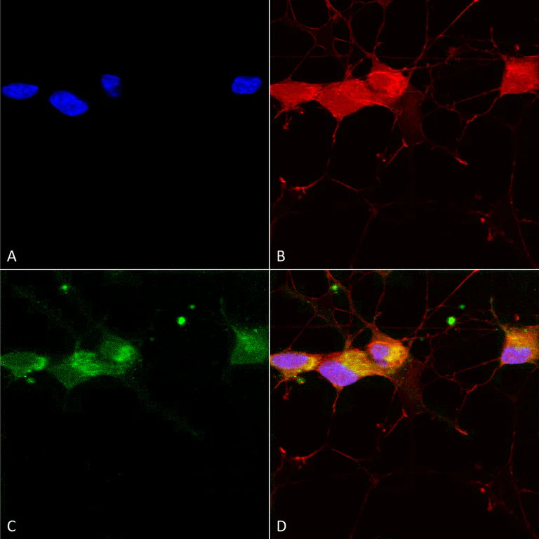 Immunocytochemistry/ Immunofluorescence - Anti-NMDAR2B antibody [S59] (AB93610)