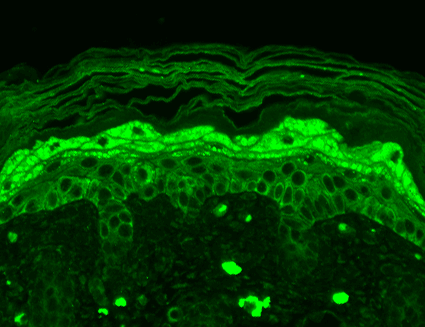 Immunohistochemistry (Formalin/PFA-fixed paraffin-embedded sections) - Anti-NMDAR2B antibody [S59] (AB93610), expandable thumbnail