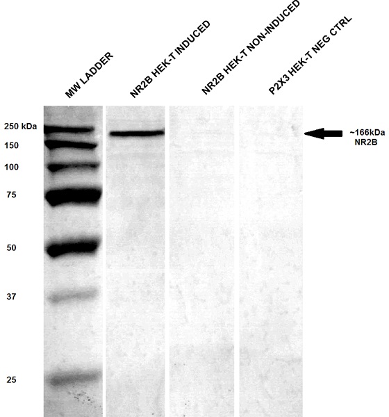 Western blot - Anti-NMDAR2B antibody [S59] (AB93610), expandable thumbnail