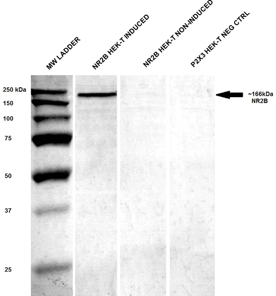Western blot - Anti-NMDAR2B antibody [S59] (AB93610)