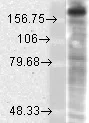 Western blot - Anti-NMDAR2B antibody [S59] (AB93610)