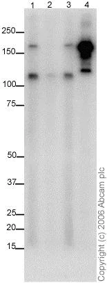 Western blot - Anti-NMDAR2B (phospho Y1252) antibody (AB18532)