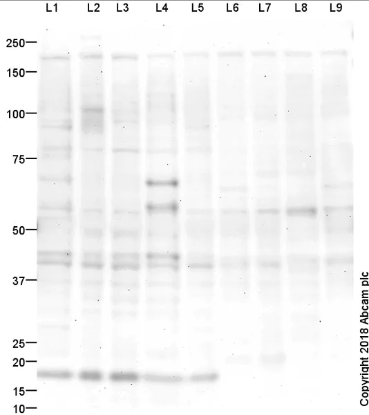 Western blot - Anti-NMDAR2B (phospho Y1252) antibody (AB18532)