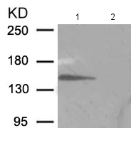 Western blot - Anti-NMDAR2B (phospho Y1336) antibody (AB193286)