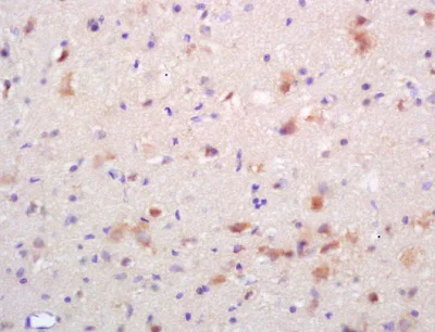 Immunohistochemistry (Formalin/PFA-fixed paraffin-embedded sections) - Anti-NMDAR2B (phospho Y1336) antibody (AB215439)