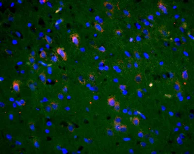 Immunohistochemistry (Formalin/PFA-fixed paraffin-embedded sections) - Anti-NMDAR2B (phospho Y1336) antibody (AB215439)