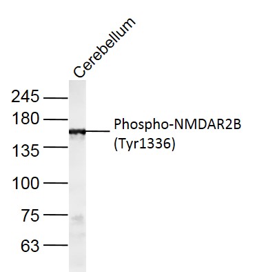 Western blot - Anti-NMDAR2B (phospho Y1336) antibody (AB215439)