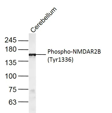 Western blot - Anti-NMDAR2B (phospho Y1336) antibody (AB215439)