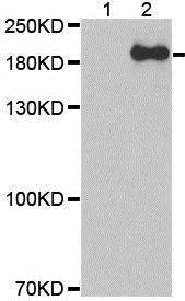 Western blot - Anti-NMDAR2B (phospho Y1474) antibody (AB194923)