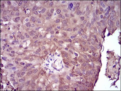 Immunohistochemistry (Formalin/PFA-fixed paraffin-embedded sections) - Anti-NME2 antibody [4G7A8] (AB204958), expandable thumbnail