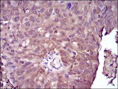 Immunohistochemistry (Formalin/PFA-fixed paraffin-embedded sections) - Anti-NME2 antibody [4G7A8] (AB204958)