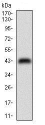 Western blot - Anti-NME2 antibody [4G7A8] (AB204958), expandable thumbnail