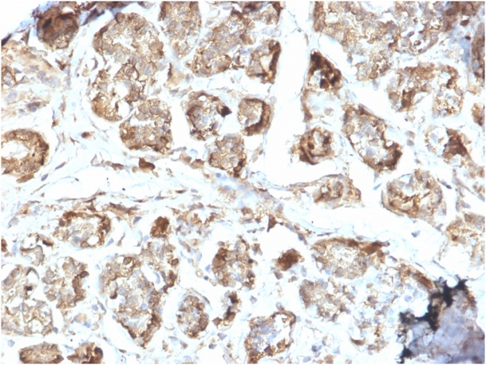 Immunohistochemistry (Formalin/PFA-fixed paraffin-embedded sections) - Anti-NME2 antibody [CPTC-NME2-2] (AB268089)