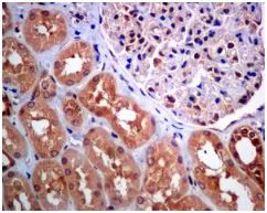 Immunohistochemistry (Formalin/PFA-fixed paraffin-embedded sections) - Anti-NME2 antibody [EPR8351] (AB131329)