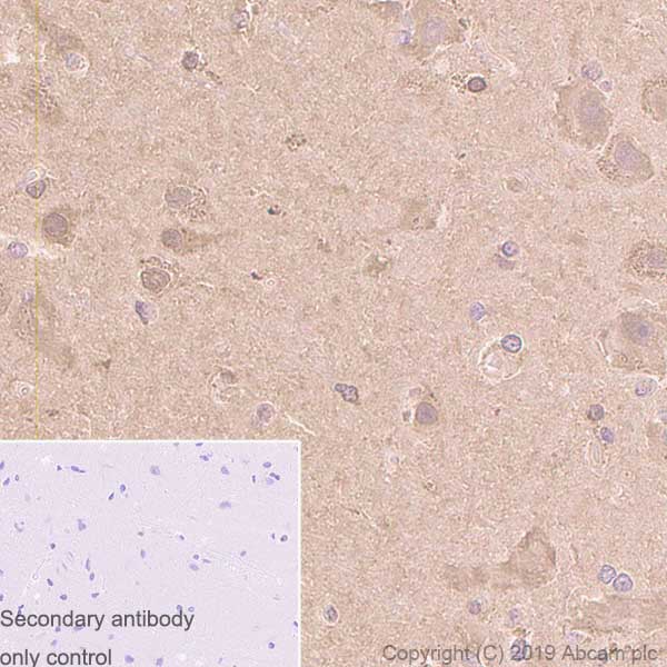 Immunohistochemistry (Formalin/PFA-fixed paraffin-embedded sections) - Anti-NME2 antibody [EPR8351] - BSA and Azide free (AB248409)