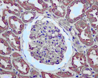Immunohistochemistry (Formalin/PFA-fixed paraffin-embedded sections) - Anti-NME3 antibody [EPR13117] (AB181257)