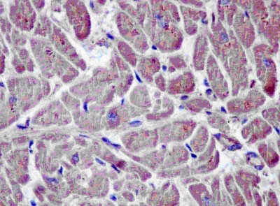 Immunohistochemistry (Formalin/PFA-fixed paraffin-embedded sections) - Anti-NME3 antibody [EPR13117] (AB181257)